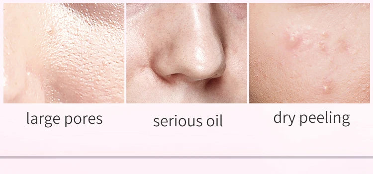 DR RASHEL Nicotinine Emulsion Rejuvenates The Skin Moisturizes And Brightens The Complexion
