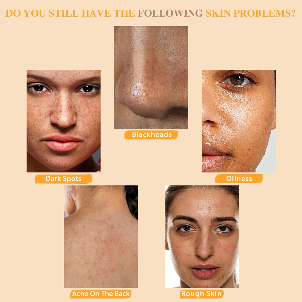 Turmeric Kojic Acid Soap Massage Soap Handmade Soap for Face and Bath for Deep Cleansing, Exfoliation, Body Moisturizing