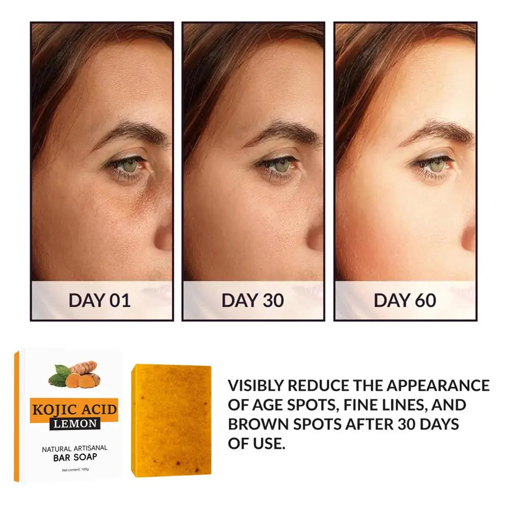 Turmeric Lemon Kojic Soap Hand Made Soap Lemon Kojic Acid Soap Shower And Facial Soap Body Skin Care Glowing Skin Best Soap Ever