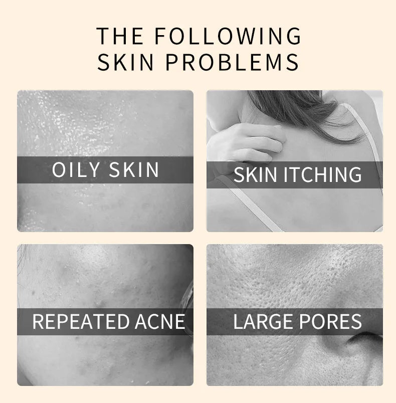 Kojic Acid 100g Whitening Soap, Glutathione Skin Lightening, Anti-aging & Moisturizing Handmade Soap for Face & Body