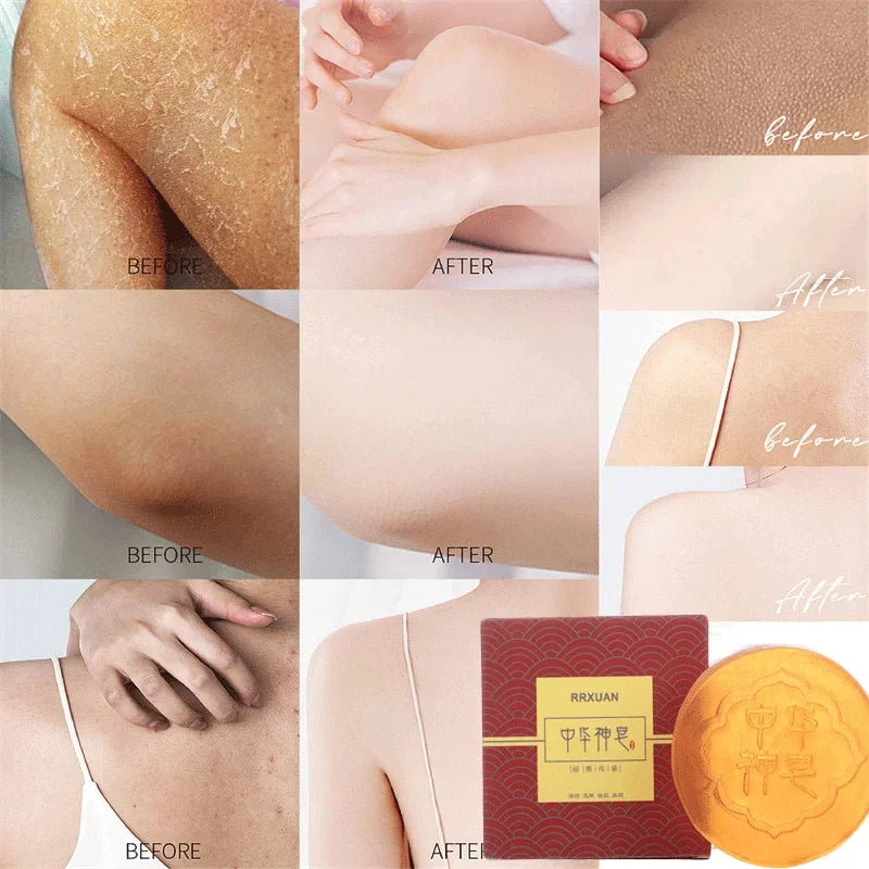 Body Whitening Soap Deep Clean Skin Chicken Skin Removal Soap Armpit Underarm Knees Bleaching Body Brighten White Care Products