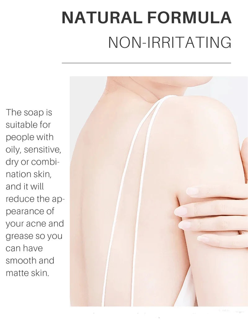 Body Whitening Soap Deep Clean Skin Chicken Skin Removal Soap Armpit Underarm Knees Bleaching Body Brighten White Care Products